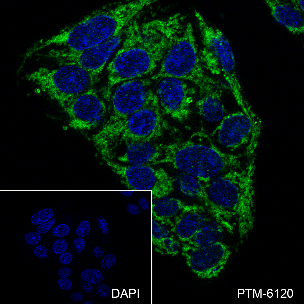 Anti-PHB1 Rabbit mAb