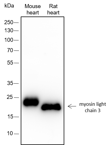Anti-Myosin Light Chain 3 Rabbit mAb