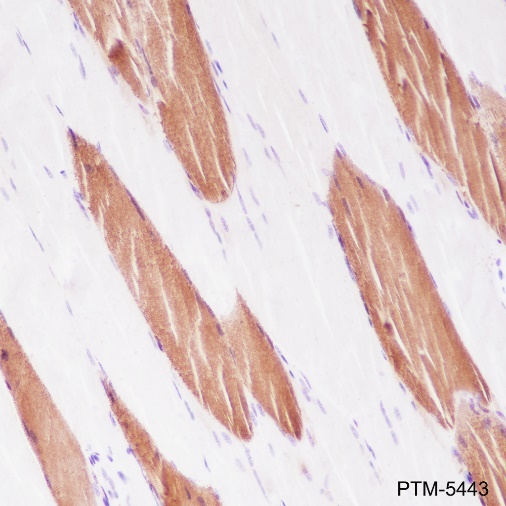 Anti-Myosin Light Chain 3 Rabbit mAb