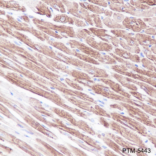 Anti-Myosin Light Chain 3 Rabbit mAb