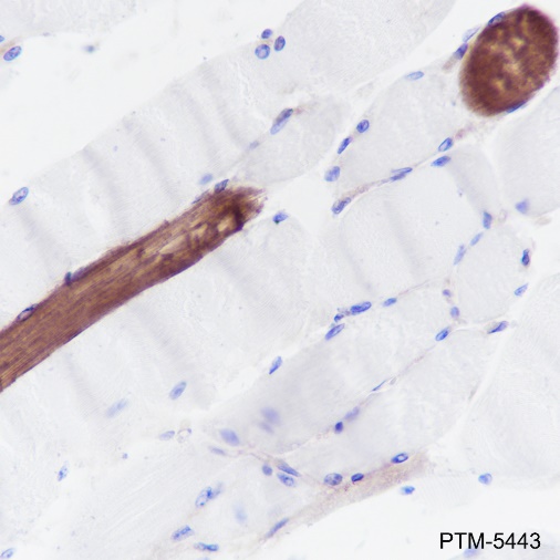 Anti-Myosin Light Chain 3 Rabbit mAb