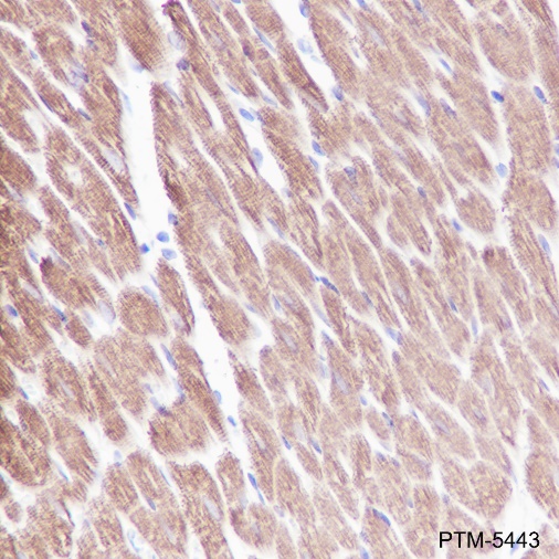 Anti-Myosin Light Chain 3 Rabbit mAb