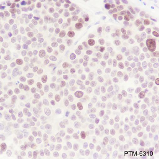 Anti-EZH2 Mouse mAb