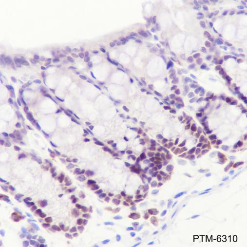 Anti-EZH2 Mouse mAb