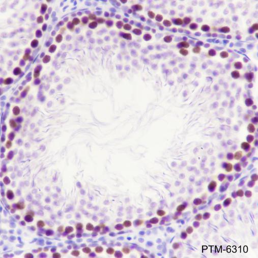 Anti-EZH2 Mouse mAb