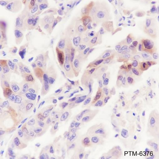 Anti-UBE2C Mouse mAb