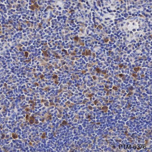 Anti-UBE2C Mouse mAb