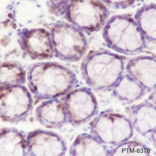 Anti-UBE2C Mouse mAb