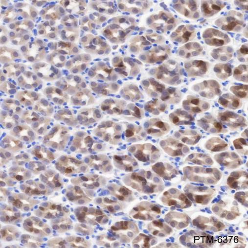 Anti-UBE2C Mouse mAb