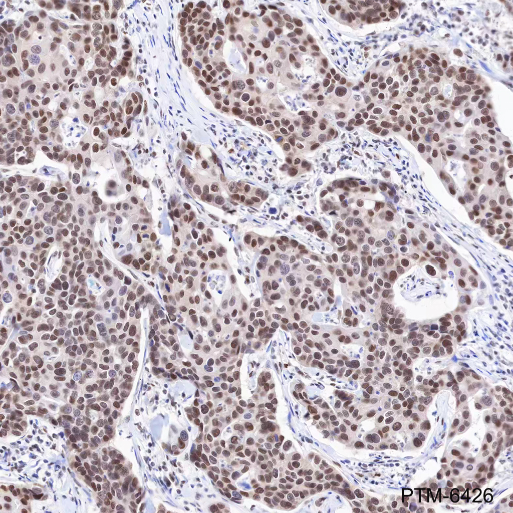 Anti-hnRNP H Mouse mAb