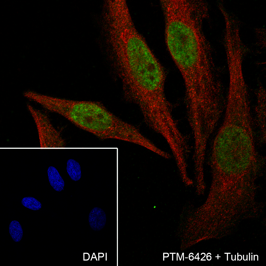 Anti-hnRNP H Mouse mAb