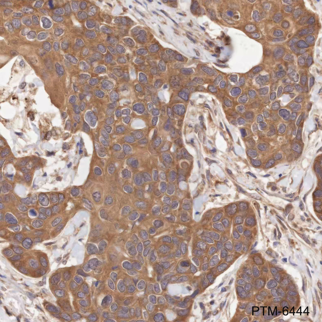 Anti-CYR61 Mouse mAb