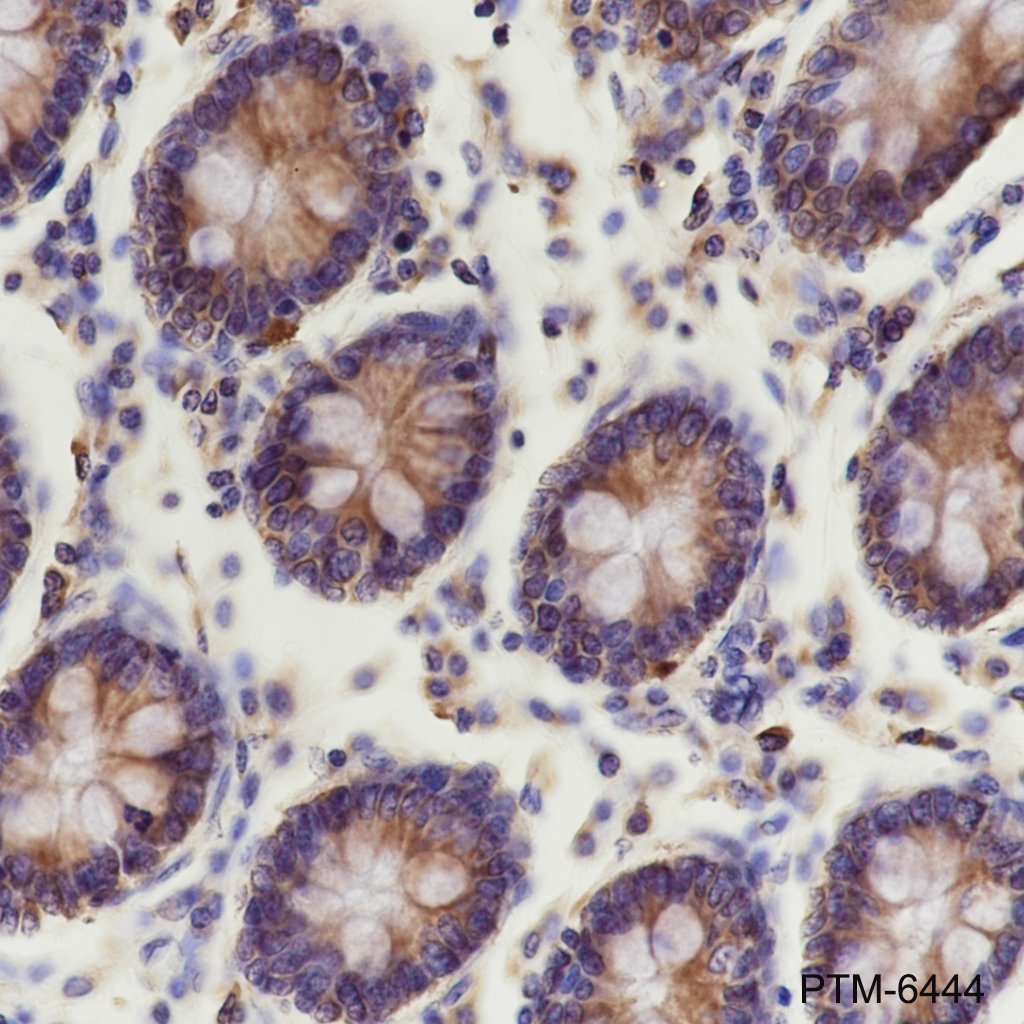 Anti-CYR61 Mouse mAb