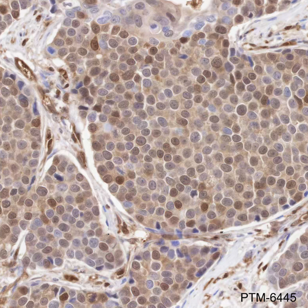 Anti-beta-Arrestin 1 Mouse mAb