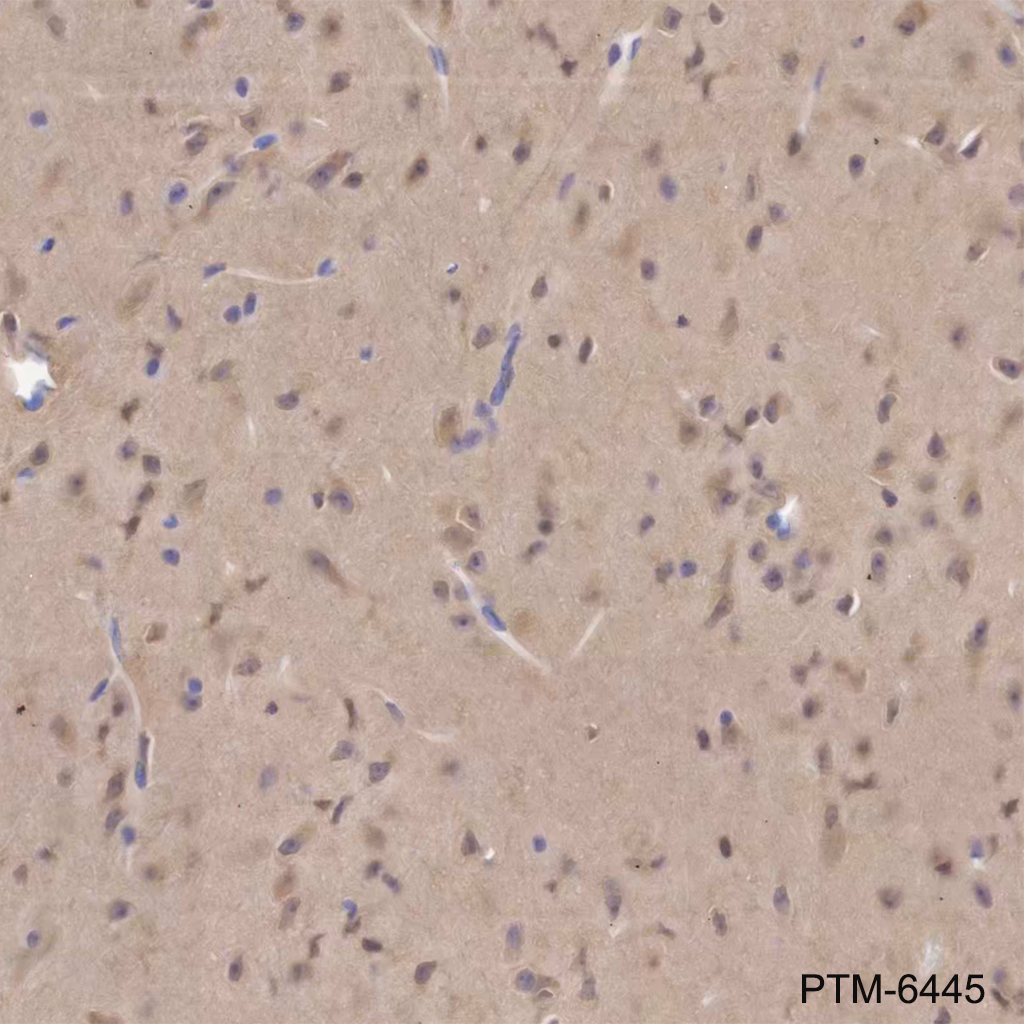 Anti-beta-Arrestin 1 Mouse mAb