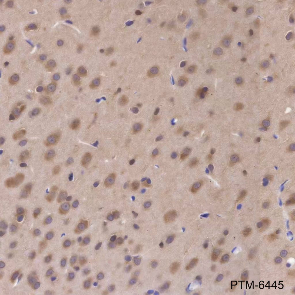 Anti-beta-Arrestin 1 Mouse mAb