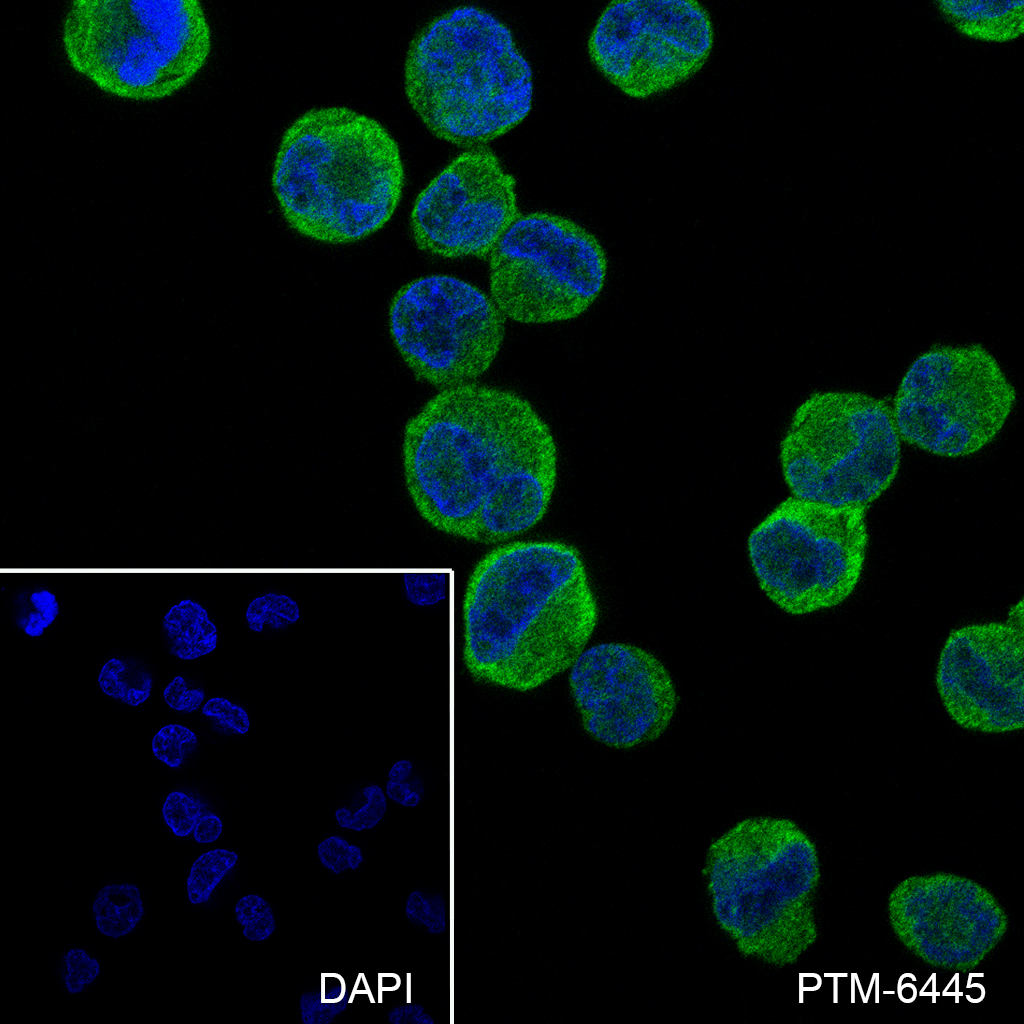 Anti-beta-Arrestin 1 Mouse mAb