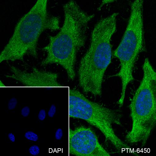 Anti-MAT2B Mouse mAb