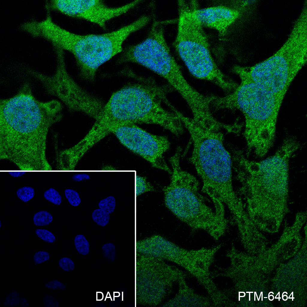 Anti-HSP40 Mouse mAb