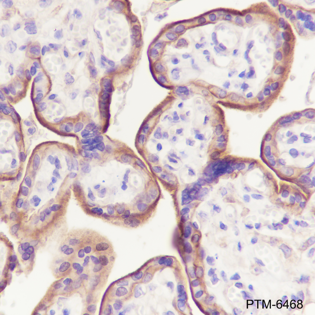 Anti-beta Dystroglycan Mouse mAb