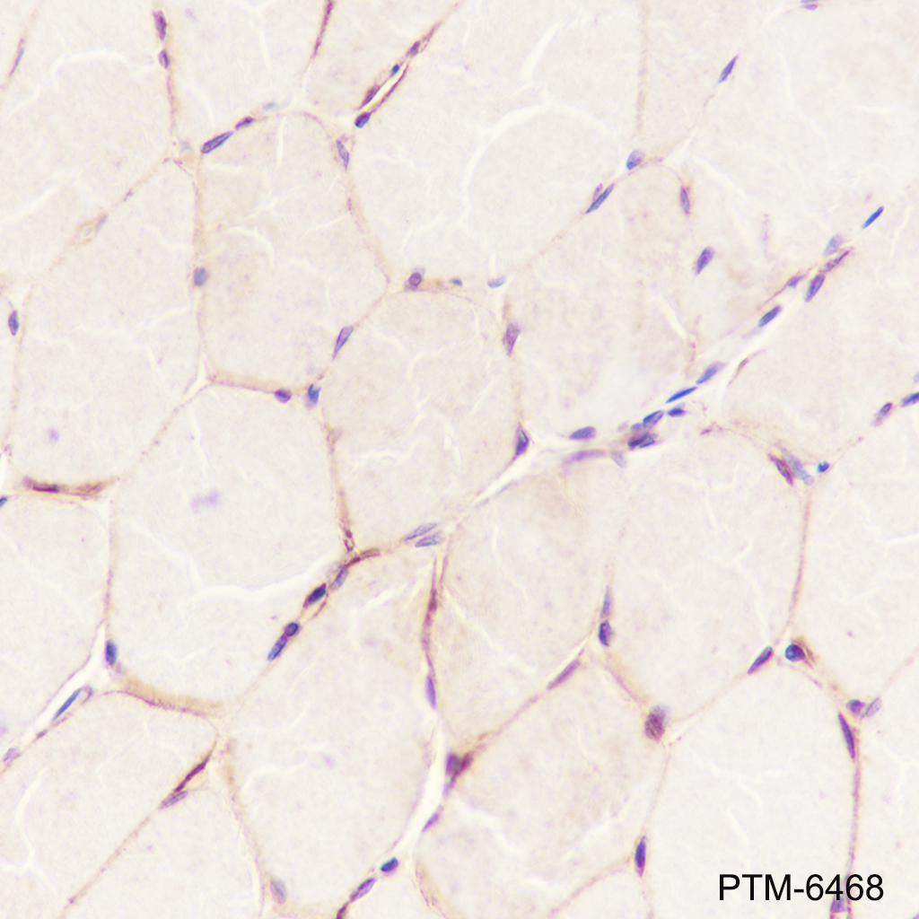 Anti-beta Dystroglycan Mouse mAb