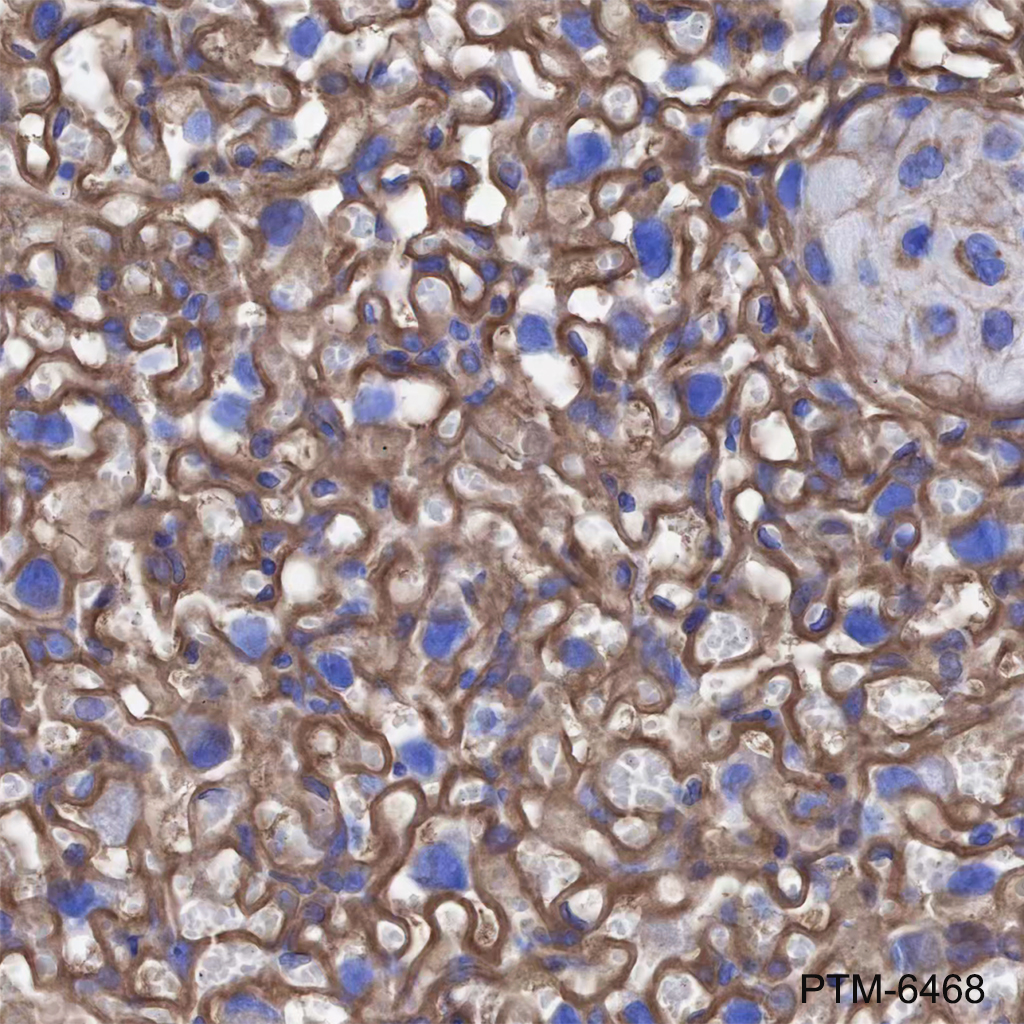 Anti-beta Dystroglycan Mouse mAb