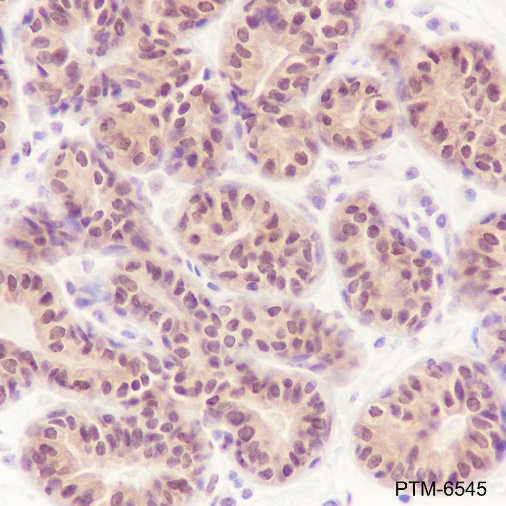 Anti-MTAP Rabbit mAb