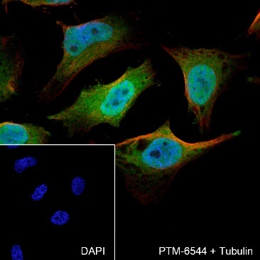 Anti-Pin1 Rabbit mAb