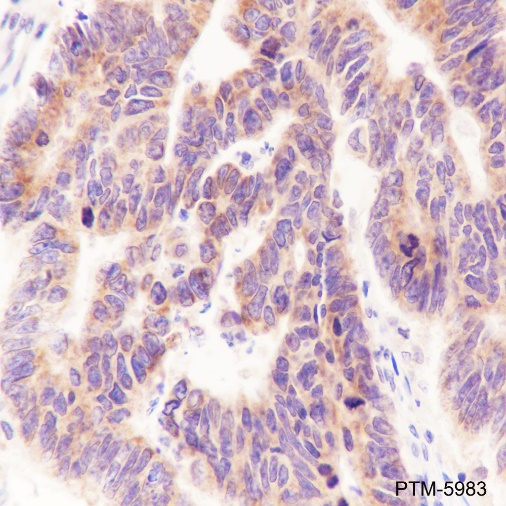Anti-MEK2 Rabbit mAb
