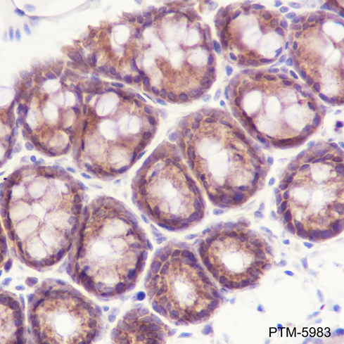 Anti-MEK2 Rabbit mAb