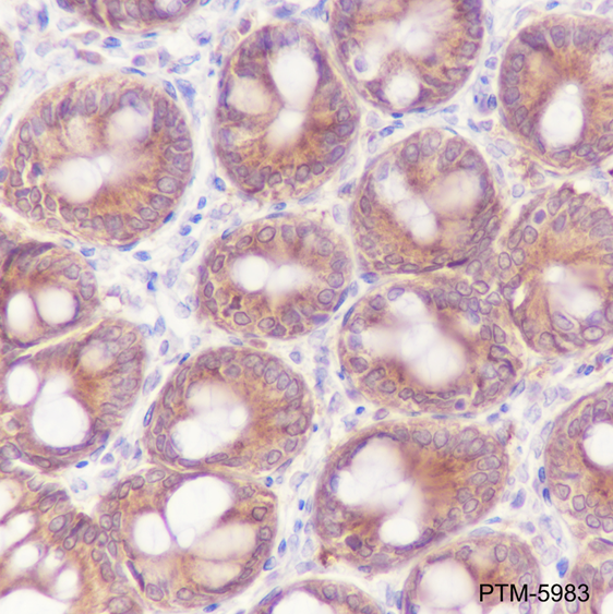 Anti-MEK2 Rabbit mAb