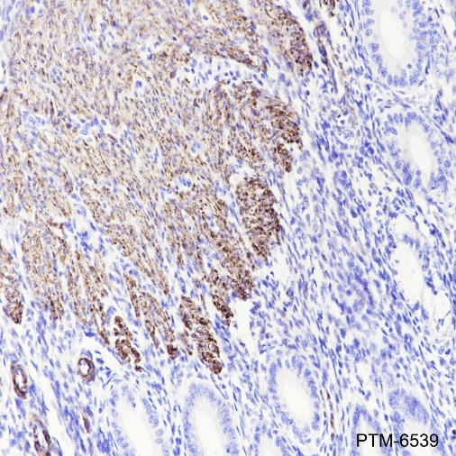Anti-Desmin Rabbit mAb
