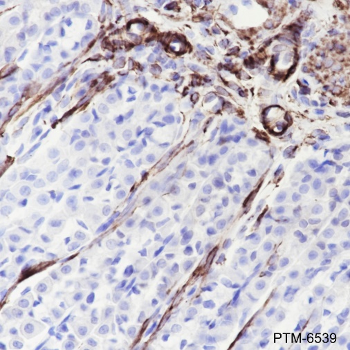 Anti-Desmin Rabbit mAb