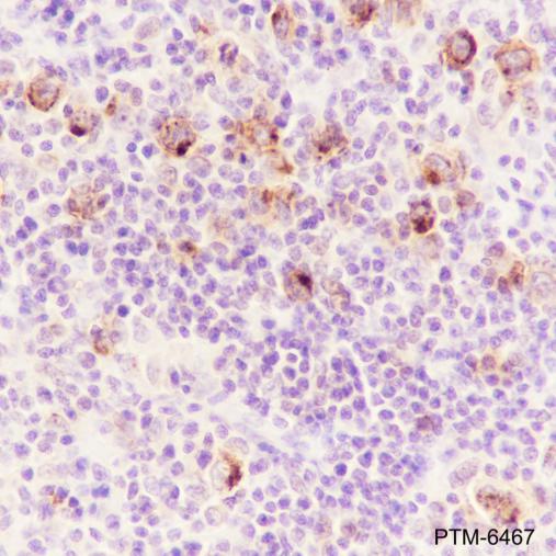 Anti-CD15/SSEA1 Mouse mAb