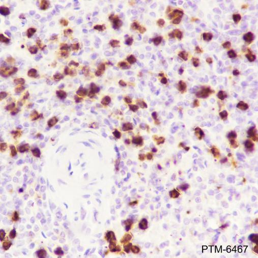 Anti-CD15/SSEA1 Mouse mAb