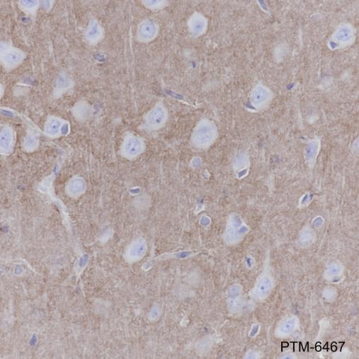 Anti-CD15/SSEA1 Mouse mAb