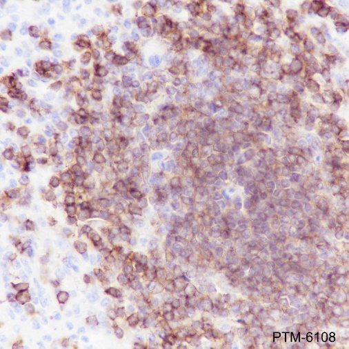 Anti-CD32B Rabbit mAb