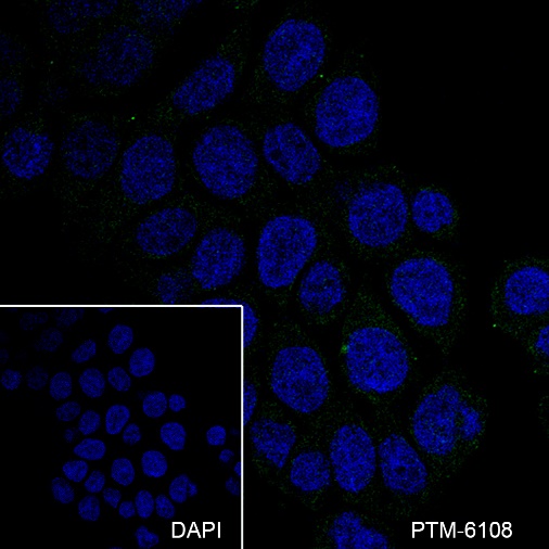 Anti-CD32B Rabbit mAb