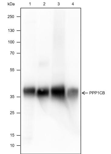 Anti-PPP1CB Rabbit mAb