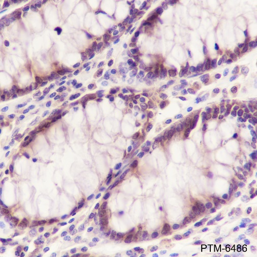 Anti-PPP1CB Rabbit mAb