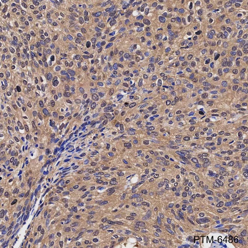 Anti-PPP1CB Rabbit mAb