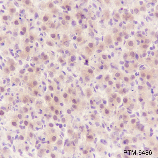 Anti-PPP1CB Rabbit mAb