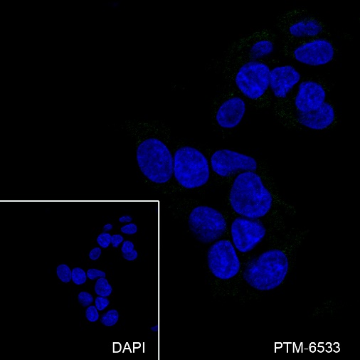 Anti-CD81 Mouse mAb