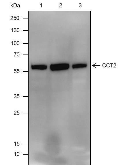 Anti-CCT2 Rabbit mAb