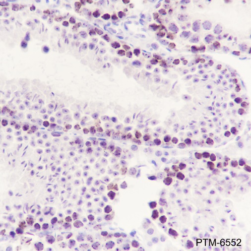 Anti-SUV39H2 Rabbit mAb