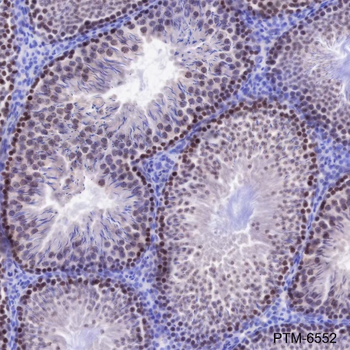 Anti-SUV39H2 Rabbit mAb