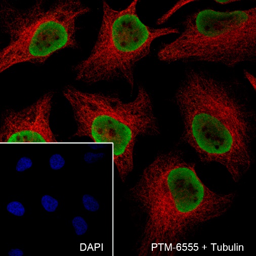 Anti-hnRNP A2/B1 Mouse mAb