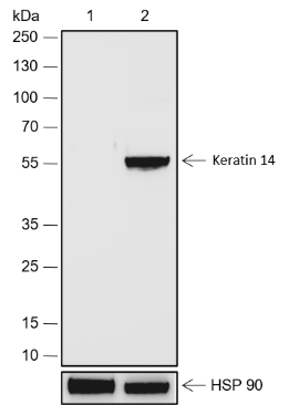 Anti-Keratin 14 Rabbit mAb