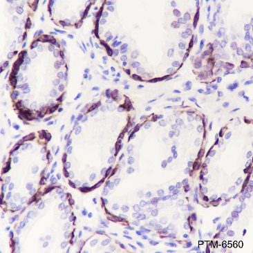 Anti-Keratin 14 Rabbit mAb