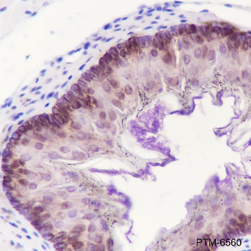 Anti-Keratin 14 Rabbit mAb